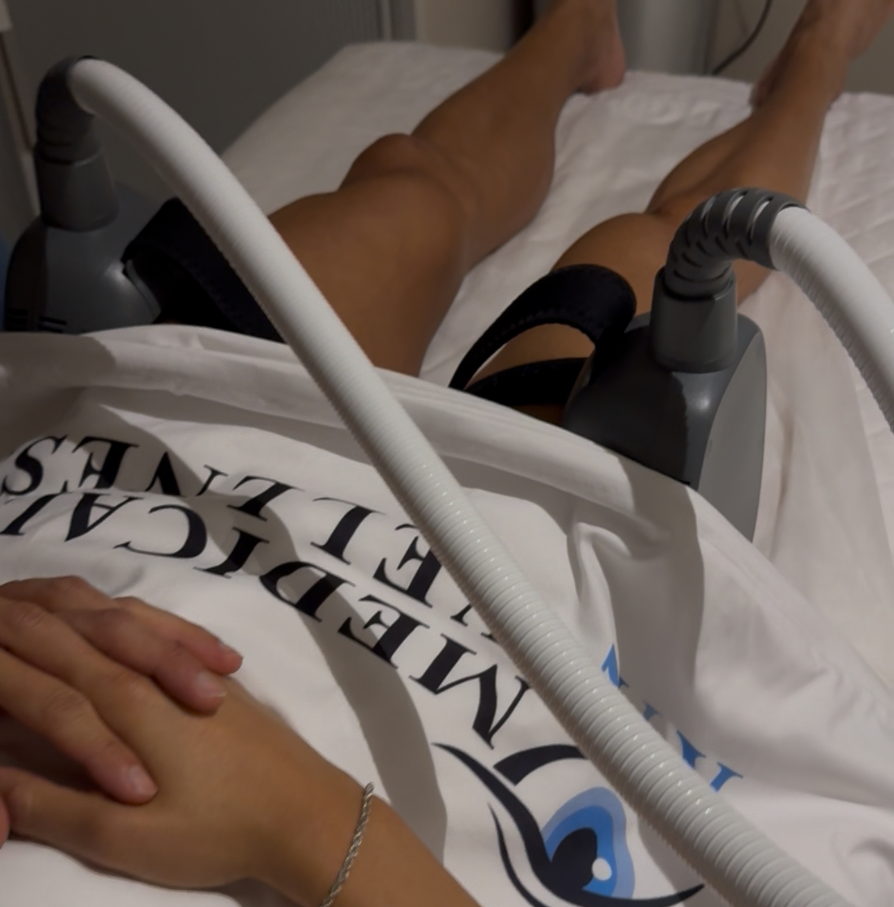 Emsculpt body contouring treatment